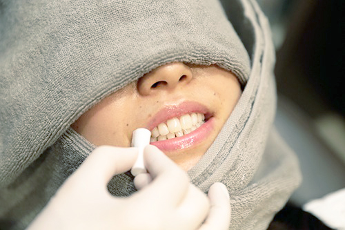 リップセラム塗布